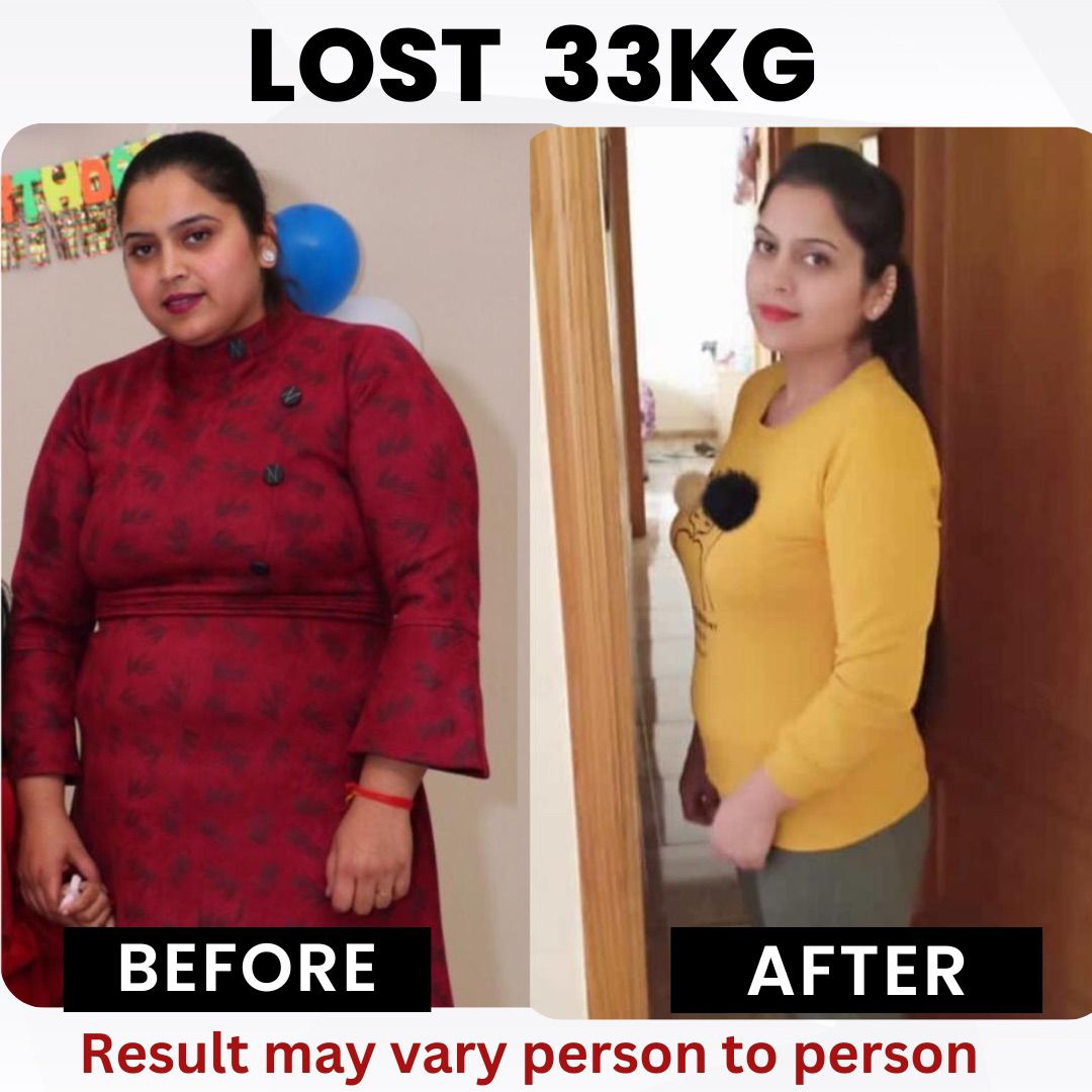 Client before and after — Lost 33 kg with RESET 90