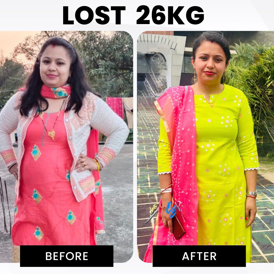 Client before and after — Lost 26 kg with RESET 90