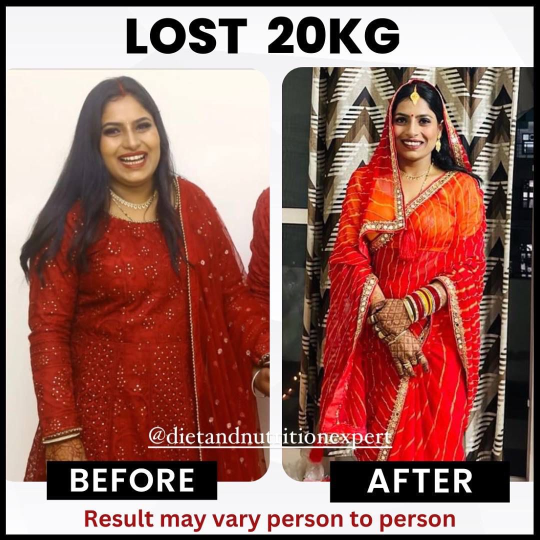 Client before and after — Lost 20 kg with RESET 90
