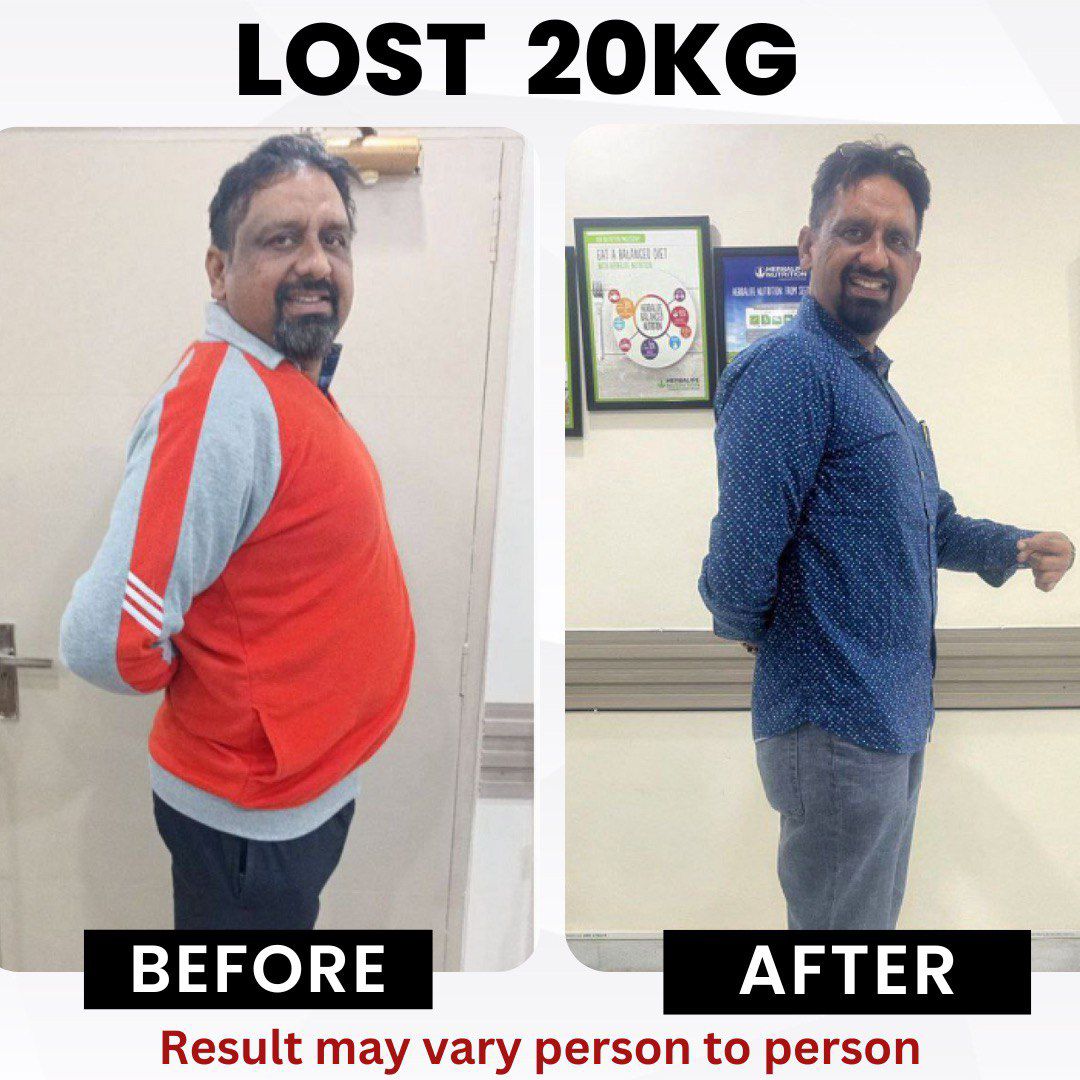 Client before and after — Lost 20 kg with RESET 90