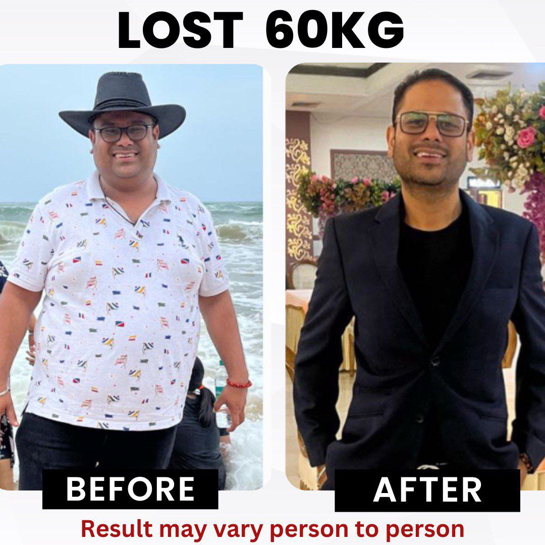 Client before and after — Lost 60 kg with RESET 90
