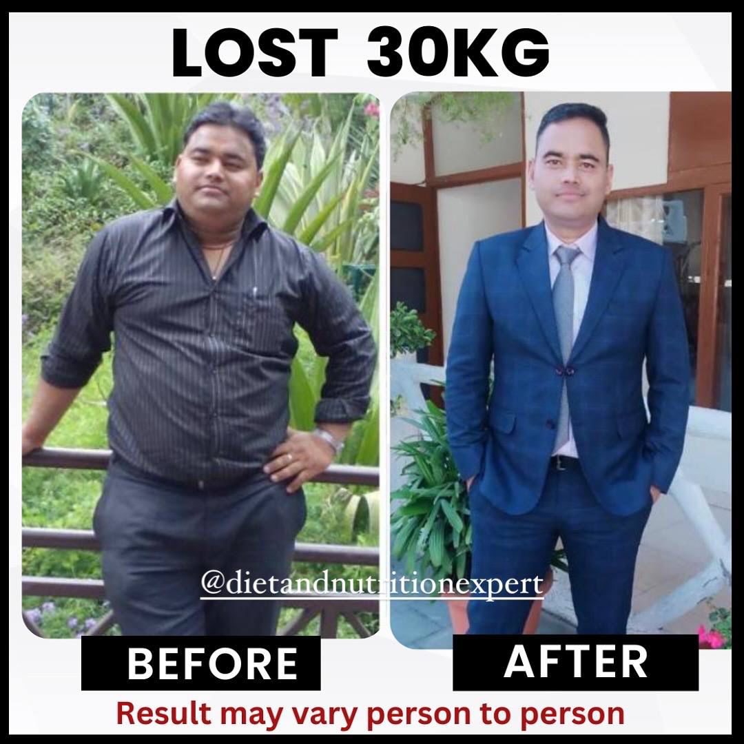 Client before and after — Lost 30 kg with RESET 90